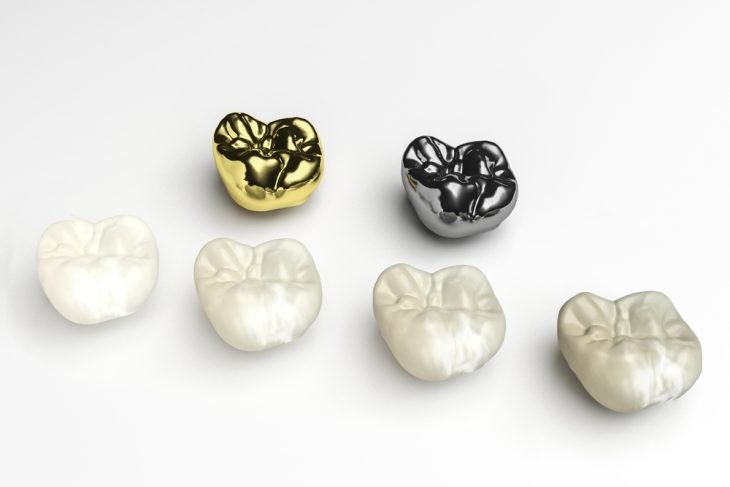best crowns in gk1 dental