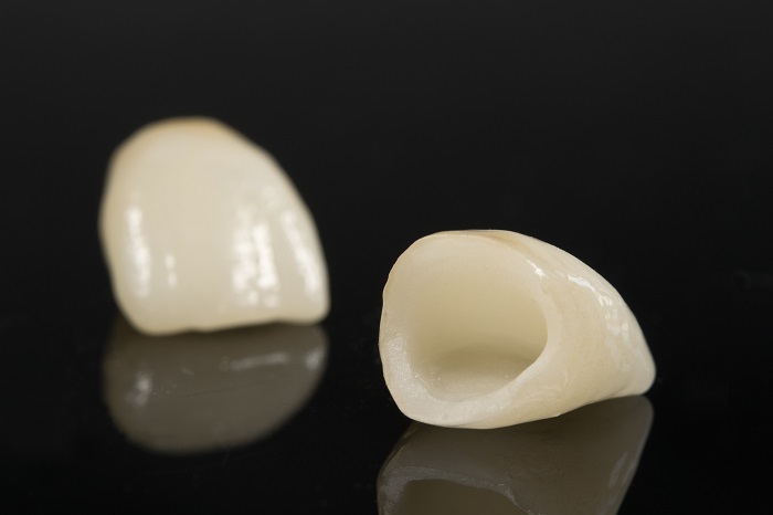 Metal Free Ceramic Crowns in South Delhi