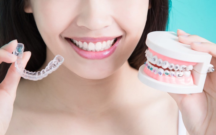 Invisalign/Invisible Braces Gk1 - South Delhi - Dentesthica