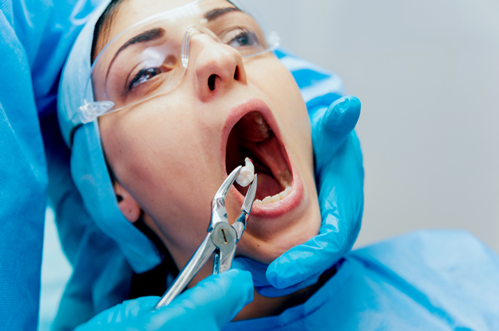 best tooth extraction in gk1 dental